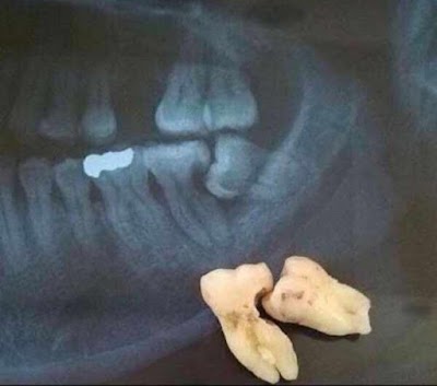 DENT2U83B6F6_Chandra_Dental_Clinic_ChIJ48AJEUsj8jkRhE8-bHLLI9M_10