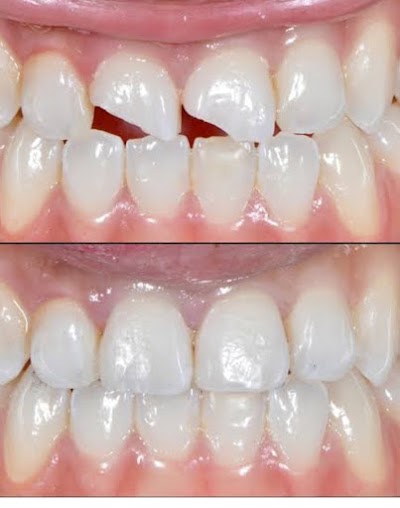 DENT2U83B6F6_Chandra_Dental_Clinic_ChIJ48AJEUsj8jkRhE8-bHLLI9M_4