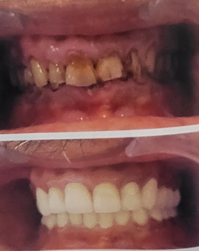 DENT2U83B6F6_Chandra_Dental_Clinic_ChIJ48AJEUsj8jkRhE8-bHLLI9M_6