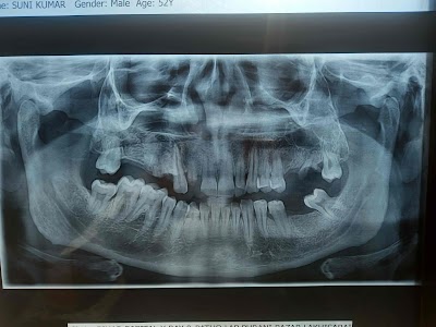 DENT6Y6Q7TSO_Shakuntala_Dental_Care_ChIJtaj6u_k98jkRMKR6sN3CmgY_7