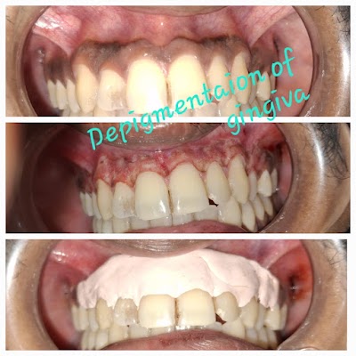 DENT9N7YTE8W_Usha_Dental_Clinic___Implant_centre_ChIJzcOEzygb8jkRWEZDfzg2d5U_6