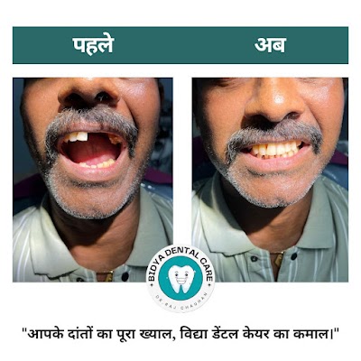 DENTAE2JHFKW_Bidya_multispeciality_dental_clinic_ChIJv8VYNmkx8jkR4SQVGzsbCdw_8