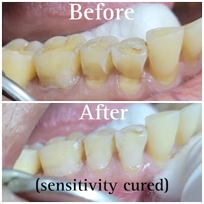 DENTBQTNBEVF_Aashirwad_Dental_Clinic_ChIJJ-9BCptD8jkR42TsKlRhJLo_10