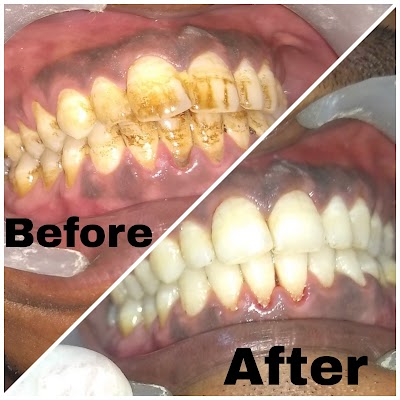 DENTBQTNBEVF_Aashirwad_Dental_Clinic_ChIJJ-9BCptD8jkR42TsKlRhJLo_6