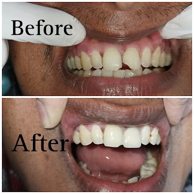DENTBQTNBEVF_Aashirwad_Dental_Clinic_ChIJJ-9BCptD8jkR42TsKlRhJLo_8