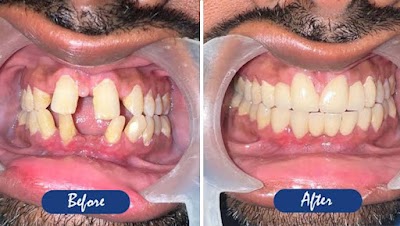 DENTLEATA10K_Nand_dental_care_ChIJtwk699oj8jkRS_XMdszMwIA_5