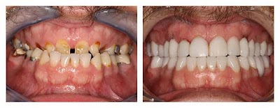 DENTLEATA10K_Nand_dental_care_ChIJtwk699oj8jkRS_XMdszMwIA_6