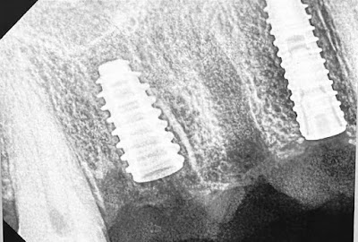 DENTU7OMQAB3_Manipal_Dental_care.Dr_Ganesh_GAURAV_ChIJI-JF7xUj8jkRxhhJTBmLCOc_2