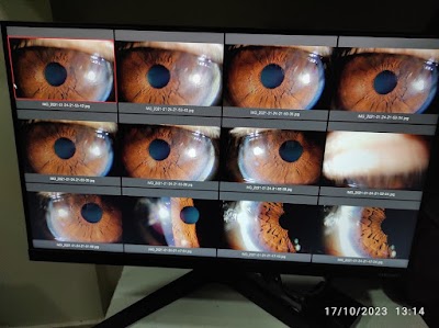 OPTB4475UA55_Jyoti_eye_care___Optical_ChIJM3RUNAAb8jkRq901DS0zWuk_5