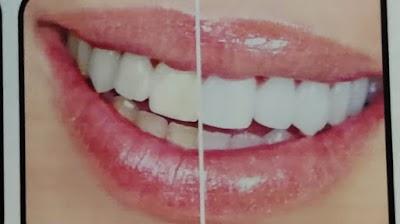 DENT9N7YTE8W_Usha_Dental_Clinic___Implant_centre_ChIJzcOEzygb8jkRWEZDfzg2d5U_1