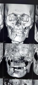 DENTNGPPO4H7_Dr_Gaurav_ChIJsYMXRAAb8jkRl-RE4S4q76U_3