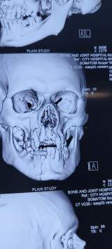 DENTNGPPO4H7_Dr_Gaurav_ChIJsYMXRAAb8jkRl-RE4S4q76U_5