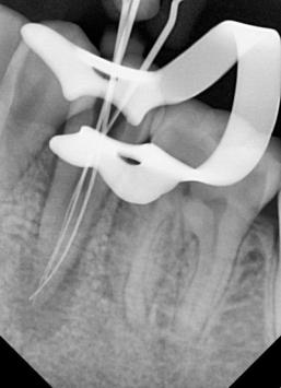 DENTVDFDIW5D_Advance_Dental_Care_-_Dentist___Dental_Surgeon_ChIJ3XTmwiob8jkR6rXLSEj6smk_4