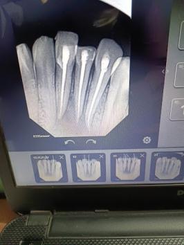 DENTX2RAC037_Dr_Ashish_S_and_Rajni_B_-_Maa_Gayatri_Dental_Clinic_-_RCT_and_Implant_Specialist_ChIJI0xYhssa8jkRGB7Sf0Zcoew_3